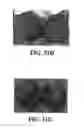 Fig. 64 - Methods and reagents for the enhancement of virus transduction in the bladder epithelium