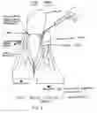 Fig. 09 - Augmentation and repair of spincter defects with cells including fibroblasts