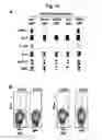 Fig. 13 - Naturally occurring IgM antibodies that bind lymphocytes