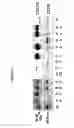 Fig. 14 - Naturally occurring IgM antibodies that bind lymphocytes