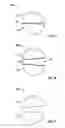 Fig. 02 - Layered pharmaceutical formulations
