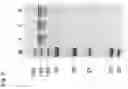 Fig. 07 - Transient protein expression methods