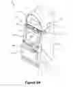 Fig. 08 - Simulated reel imperfections