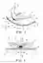 Fig. 02 - Adjustable exercise or weight device