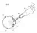 Fig. 03 - Method and device for removing and/or inhibiting of molecular structures and/or cells from or at human or animal tissue