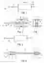 Fig. 02 - Method and relaxable distracters for in-situ formation of intervertebral disc prosthesis