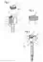 Fig. 02 - Bone anchoring device