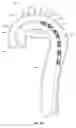 Fig. 09 - Thoracic arch stent graft and method of delivery