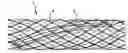 Fig. 01 - Insert for a conduit