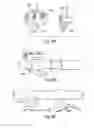 Fig. 07 - Automatically and remotely controlled brake actuator systems