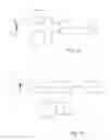 Fig. 02 - METHOD AND DEVICE FOR IDENTIFYING AN EYE THAT IS TO BE TREATED IN OPERATIONS