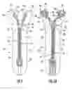 Fig. 06 - Method of manufacturing a fluidtight slide fastener