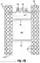Fig. 07 - APPARATUS AND METHOD FOR FORMING AN OPENING IN A CONCRETE WALL SYSTEM