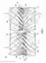 Fig. 02 - Log feed roll and flute attachment