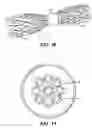 Fig. 07 - Method and apparatus for centralizing through tubing milling assemblies