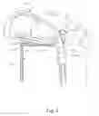 Fig. 05 - Positioning structure for golf clubs