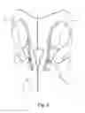 Fig. 03 - Dispensing device