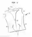 Fig. 02 - Heated garment