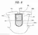 Fig. 09 - Electric rotating machine with armature coil