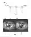 Fig. 08 - Methods and apparatus for suppressing tagging material in prepless CT colonography