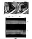 Fig. 09 - Methods and apparatus for suppressing tagging material in prepless CT colonography