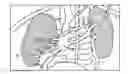 Fig. 01 - Propagating Shell for Segmenting Objects with Fuzzy Boundaries, Automatic Volume Determination and Tumor Detection Using Computer Tomography