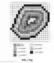 Fig. 14 - Propagating Shell for Segmenting Objects with Fuzzy Boundaries, Automatic Volume Determination and Tumor Detection Using Computer Tomography