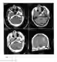 Fig. 02 - Method of Fusing Digital Images