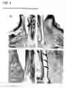 Fig. 06 - Cultured periodontal ligament cell sheet, process for producing the same and method of use thereof