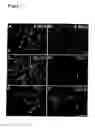 Fig. 02 - Methods and Compositions for Directing Migration of Neural Progenitor Cells