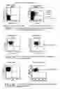 Fig. 02 - Process to carry out a cellular cardiomyoplasty