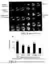 Fig. 04 - Process to carry out a cellular cardiomyoplasty