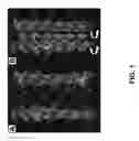 Fig. 02 - Charge-Modified Lysozyme Antimicrobial Compositions, Surfactants, and Methods for Infections and Cystic Fibrosis