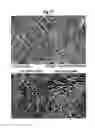 Fig. 18 - Naturally occuring IgM antibodies that bind lymphocytes