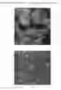 Fig. 22 - CONTROLLED RELEASE CERAMIC PARTICLES, COMPOSITIONS THEREOF, PROCESSES OF PREPARATION AND METHODS OF USE