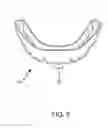 Fig. 04 - DENTAL IMPRESSION TOOL, SYSTEM, AND METHOD FOR USE WITH A DECORATIVE DENTAL OVERLAY