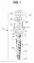 Fig. 02 - Dental implant