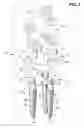 Fig. 03 - Dental implant