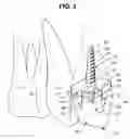 Fig. 04 - Dental implant