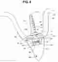 Fig. 05 - Dental implant
