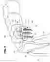 Fig. 06 - Dental implant