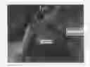 Fig. 01 - Adhesion-preventing material and process for preventing adhesion