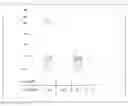 Fig. 01 - Screening Method for Agents Capable of Reversing Fusidic Acid Resistance in Bacteria