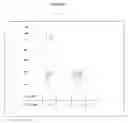Fig. 02 - Screening Method for Agents Capable of Reversing Fusidic Acid Resistance in Bacteria