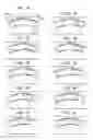 Fig. 03 - Torsional vibration damper