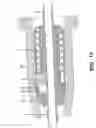 Fig. 02 - Needle shielding device