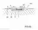 Fig. 10 - Drainage device for treating wounds using a reduced pressure
