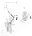 Fig. 07 - Ostomy appliance having pressure applying member