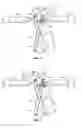 Fig. 08 - Surgical Instrument for Supplying a Counter-Torque When Securing a Spinal Prosthesis