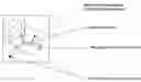 Fig. 01 - Method and system for patient-specific production of a cardiac electrode